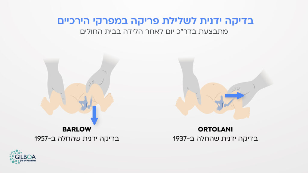 בדיקת פרקי ירכיים ידנית