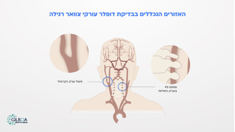 דופלר עורקי צוואר רגיל