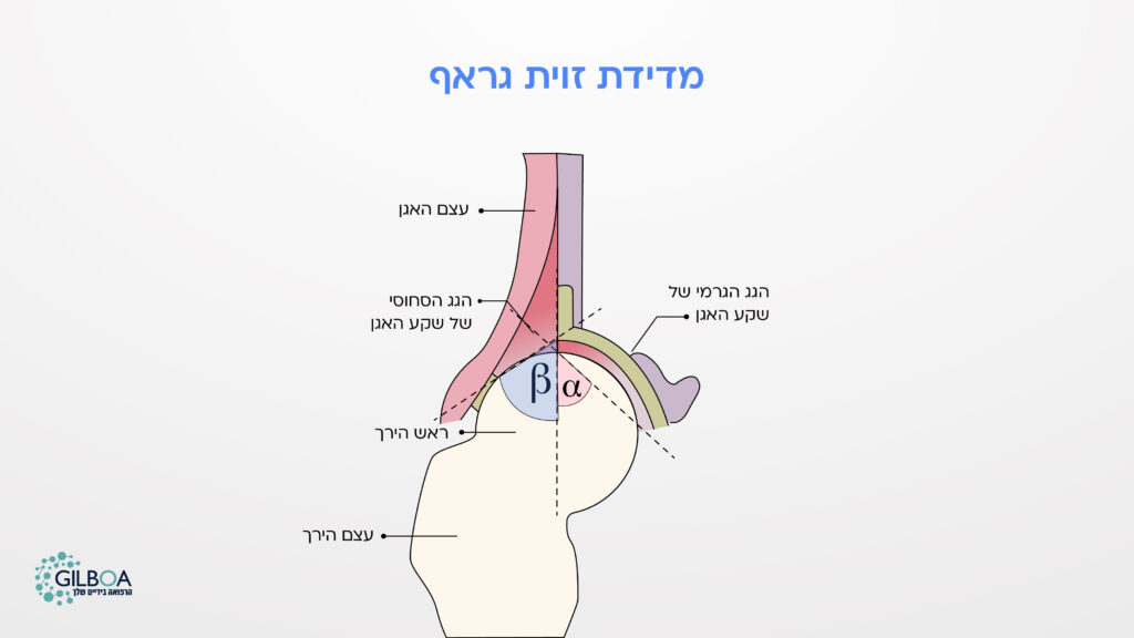 מדידת זווית גראף