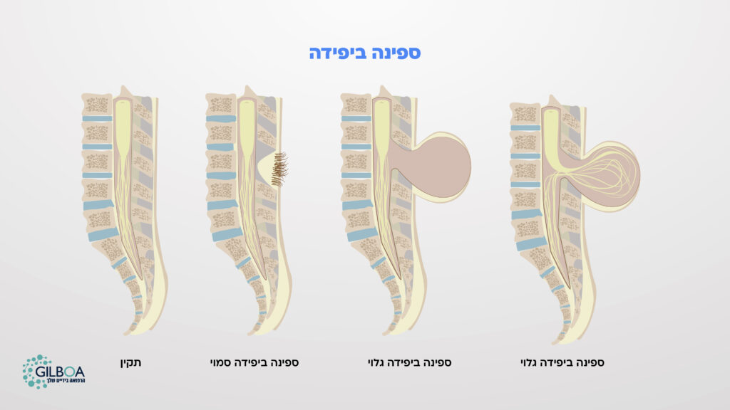 ספינה ביפידה