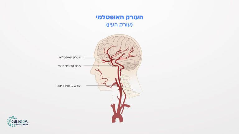 עורק העין