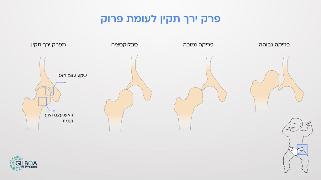 פרק ירך תקין