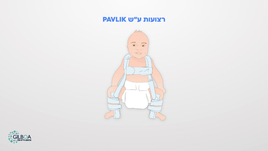 רצועות פבליק