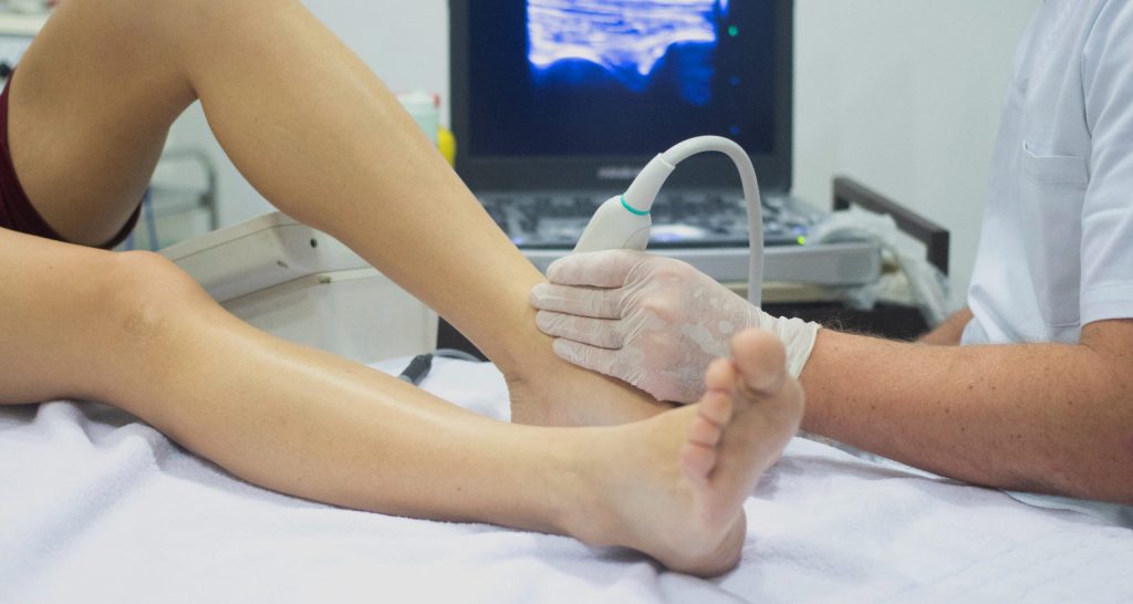 אולטרסאונד קרסול